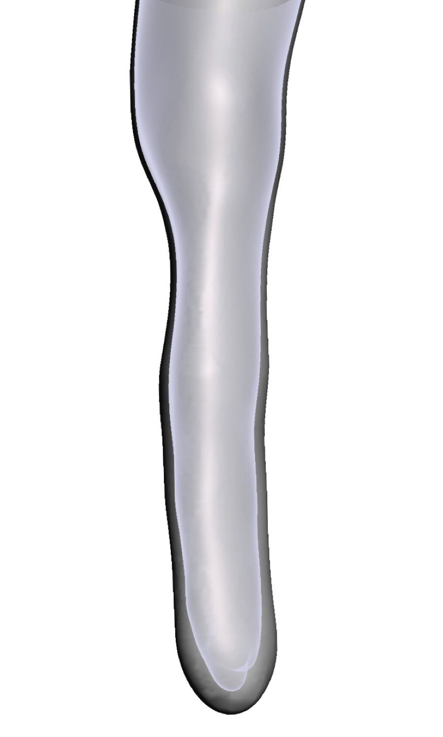 Congenital — 3D Model