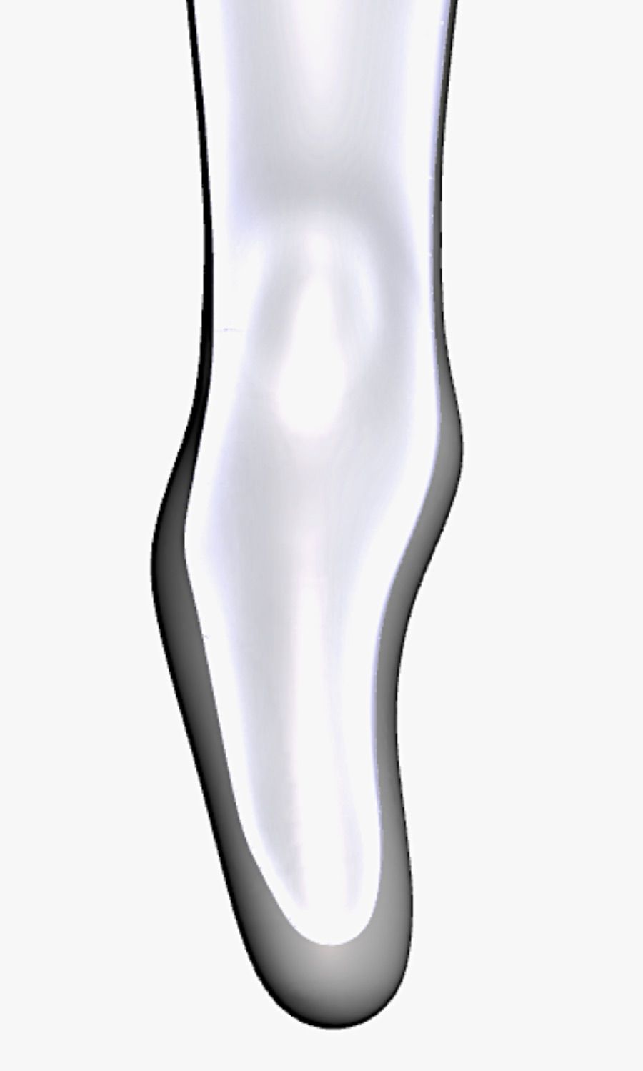 Prominent Condyle — 3D Model