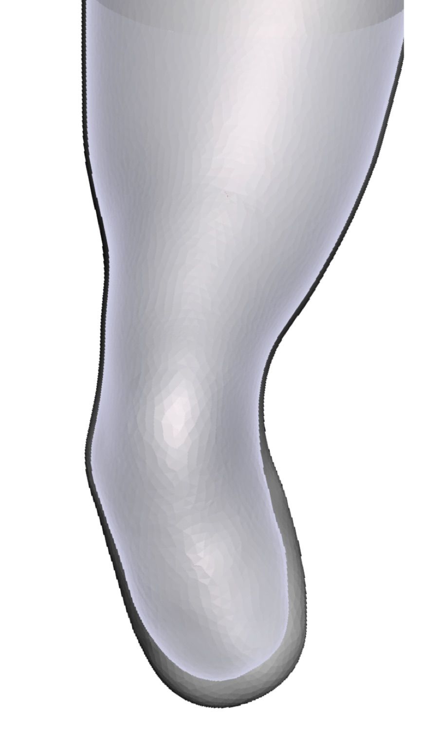 Varus/Valgus — Limb